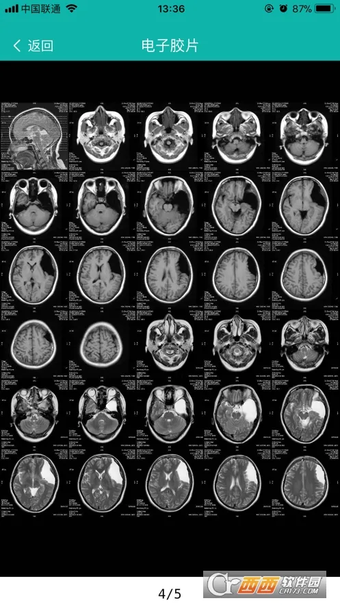 ΢Ӱҽ��(ҽѧӰ�����)